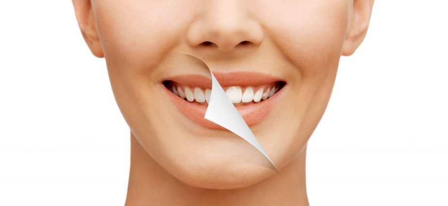How Be Well Dental Customizes Care for Each Unique Smile
