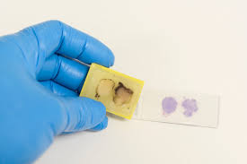Why Normal FFPE Tissue Samples Are Essential for Reliable Histological Analysis